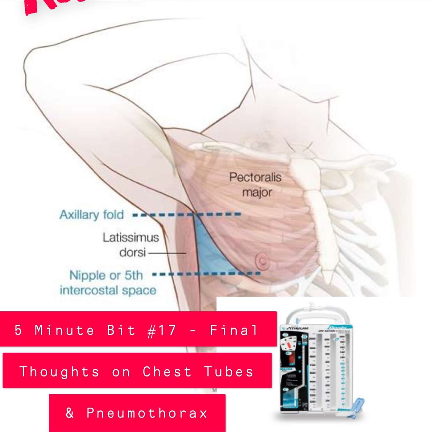 Resus Now