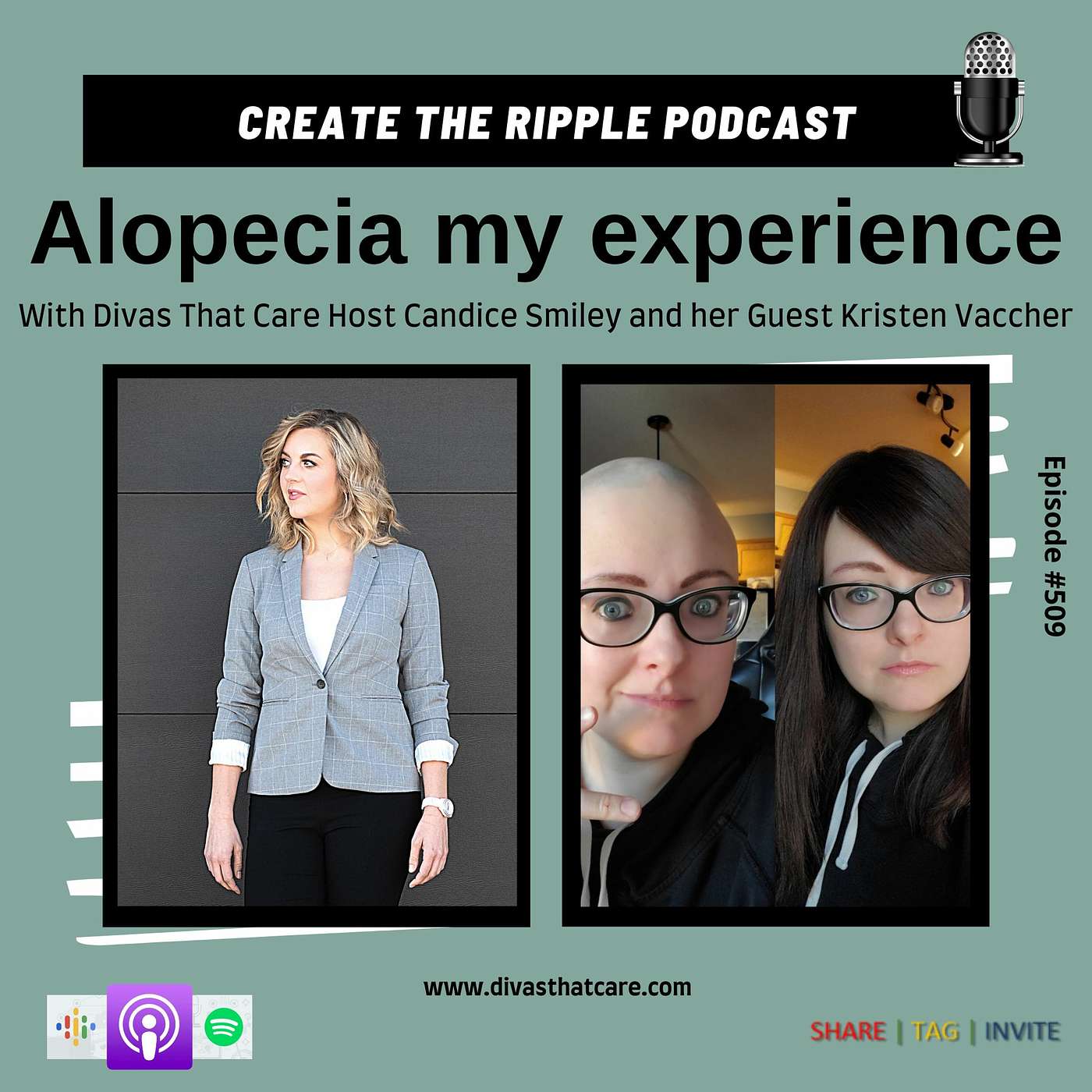 Alopecia my experience episode artwork