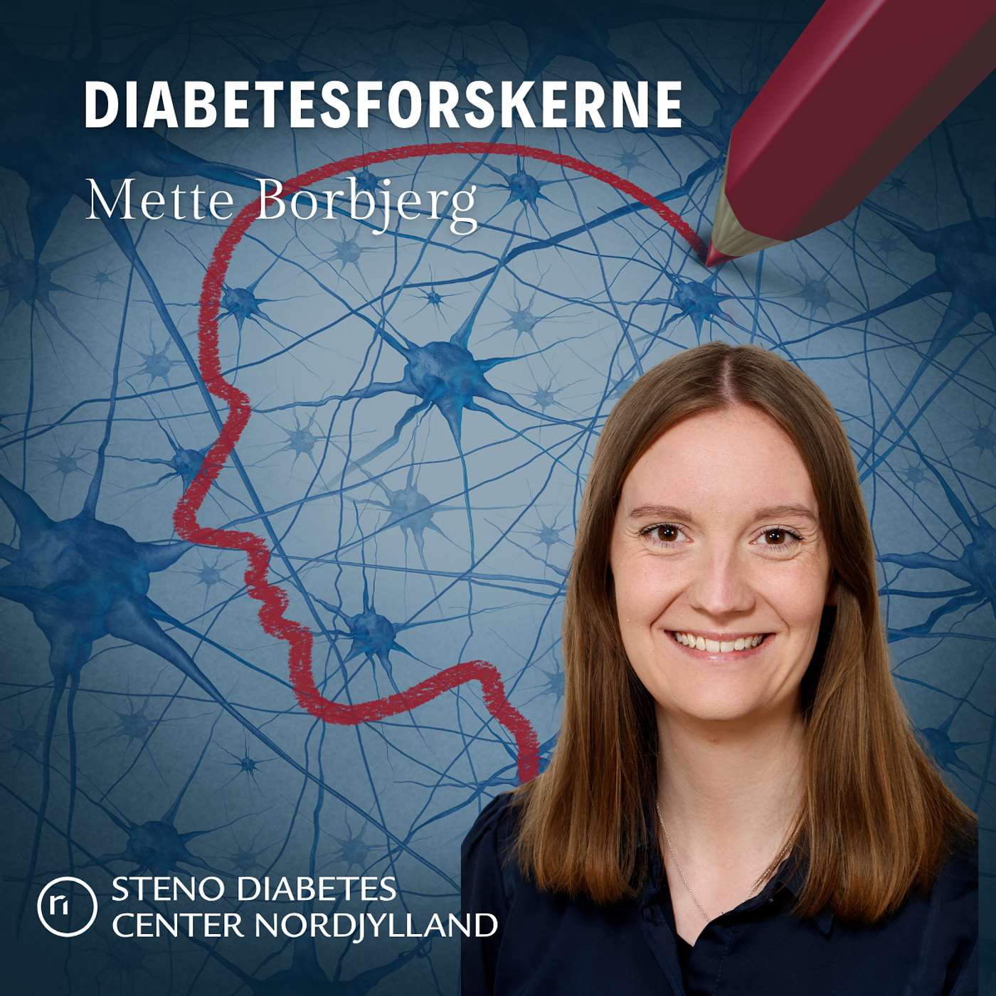 Nerveskade forværrer nervefibre i hornhinden