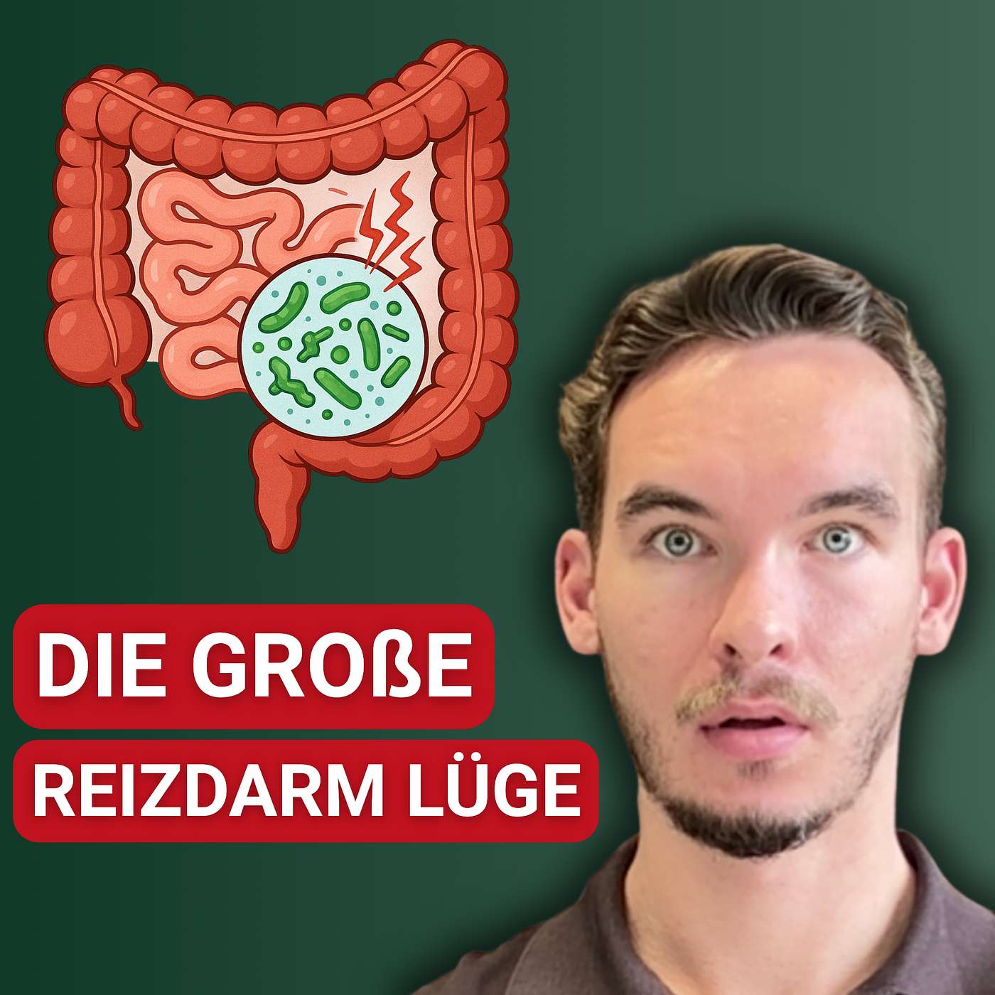 Reizdarm: Ist wirklich eine Dünndarm-Fehlbesiedelung schuld?