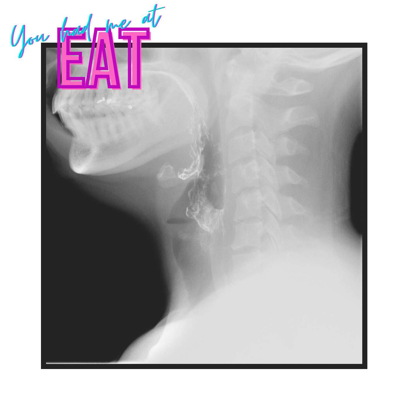 Episode 55: Barium Swallow Testing for EOE, Bon Appetit Goes Gluten Free? and Xolair