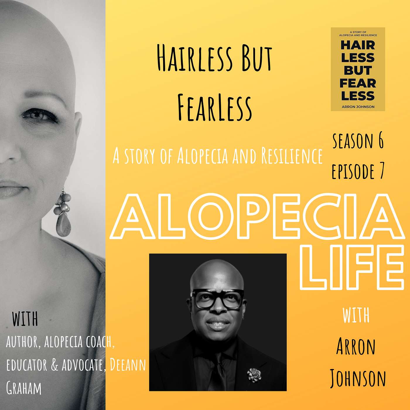 Alopecia Life