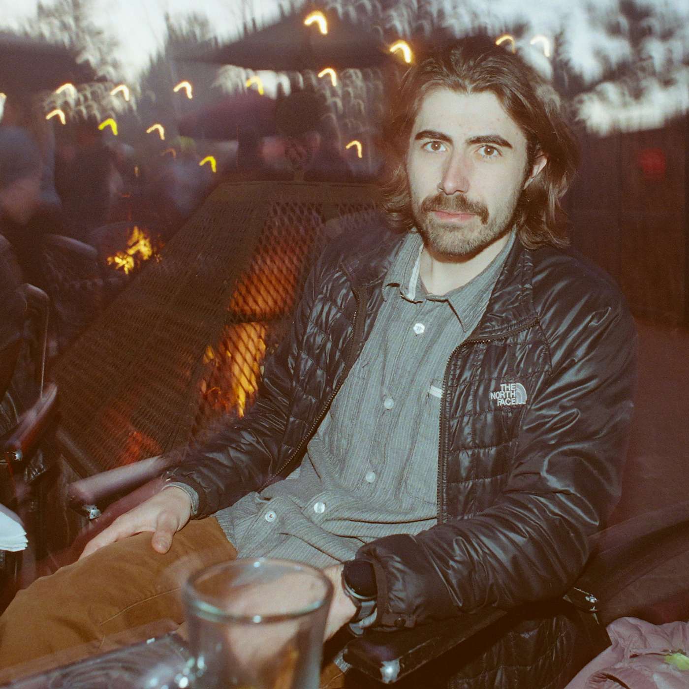 Jack Pt 2 – Looking back (muscular reconstruction surgery)