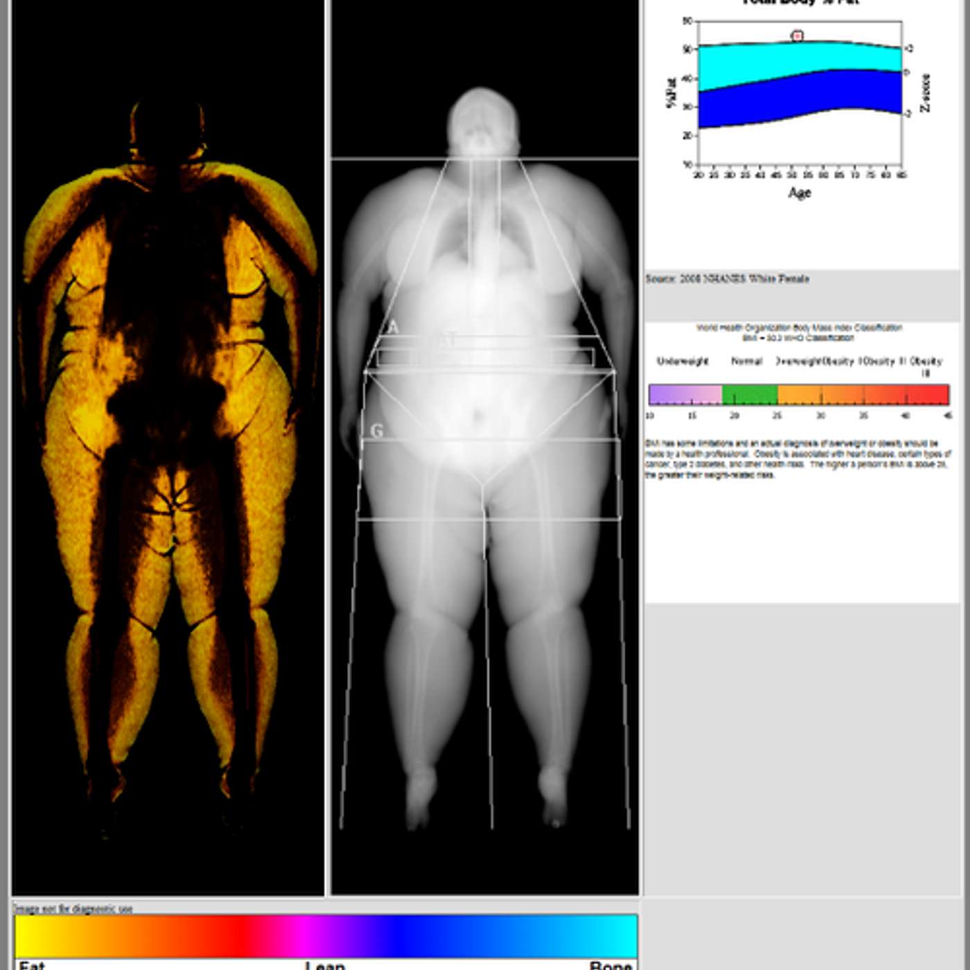 Full Scope Human Longevity