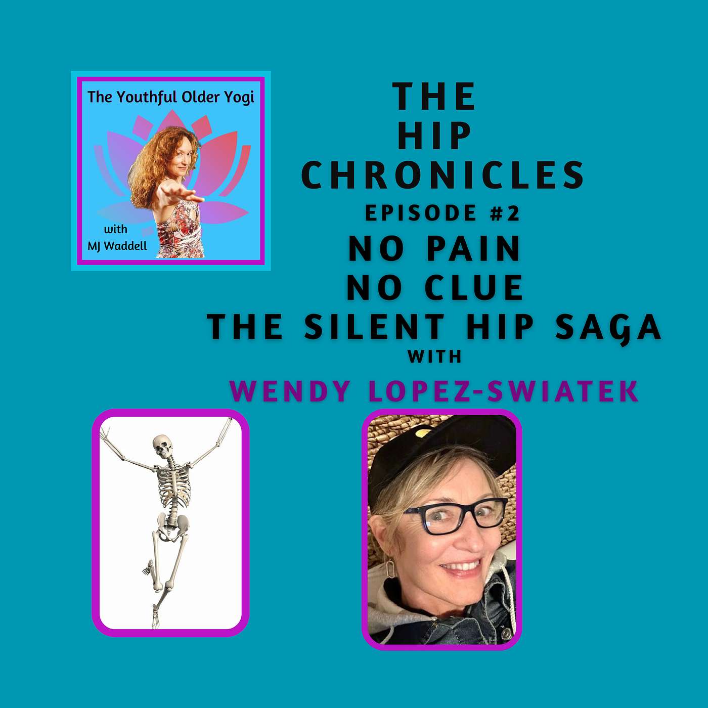 The Hip Chronicles Episode: Episode #2 No Pain, No Clue: The Silent Hip Saga