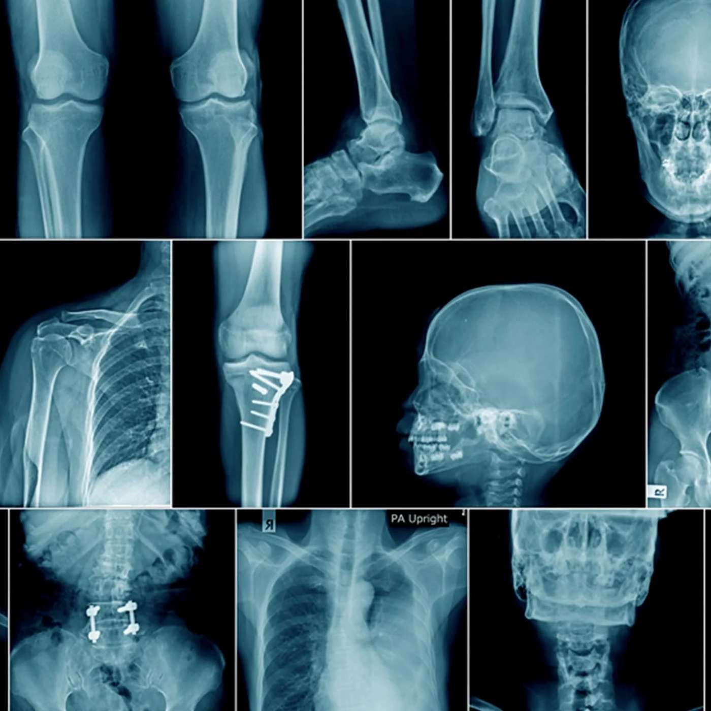 Episode 423 - Why people do, or don't, go for X-rays. (Inner Work - Part 3)