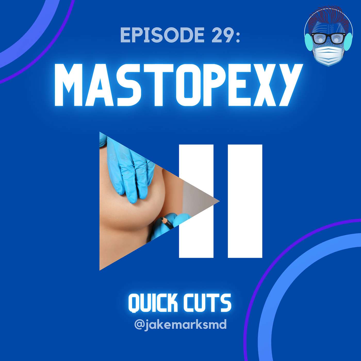 Quick Cuts: A Plastic Surgery Podcast - Episode 29: Mastopexy