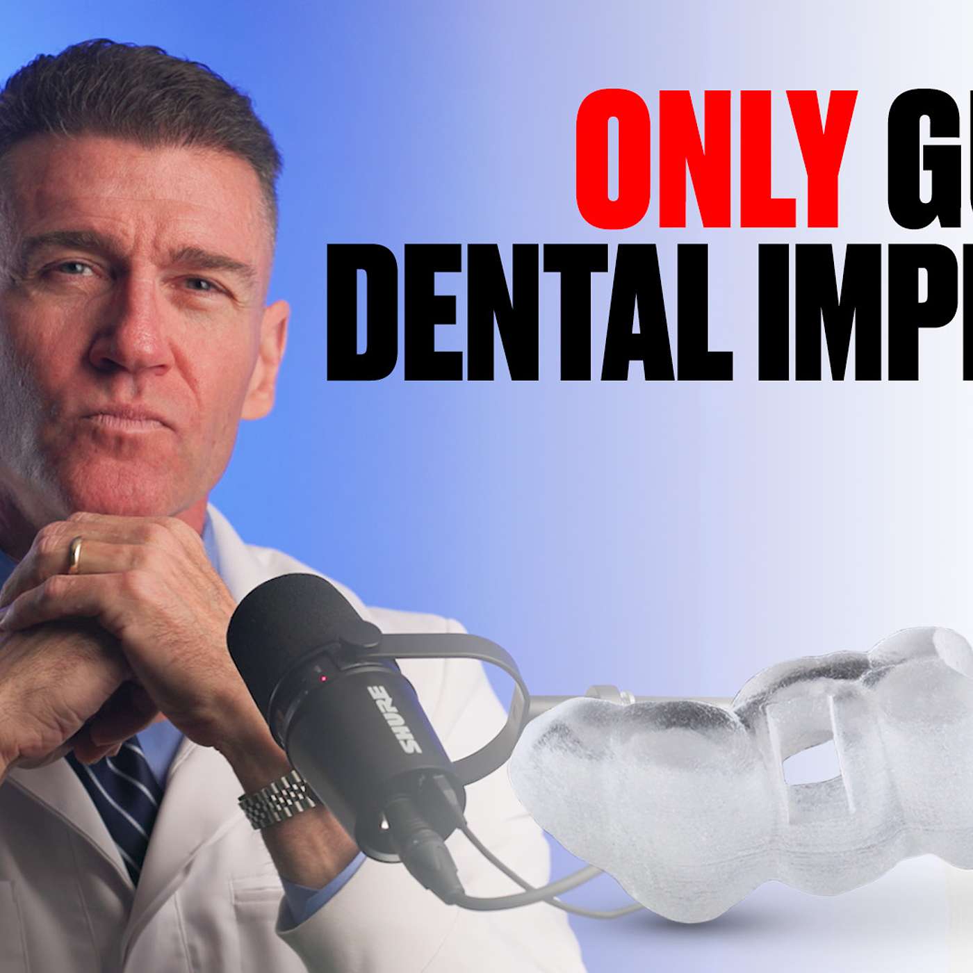 Implants Made Simple