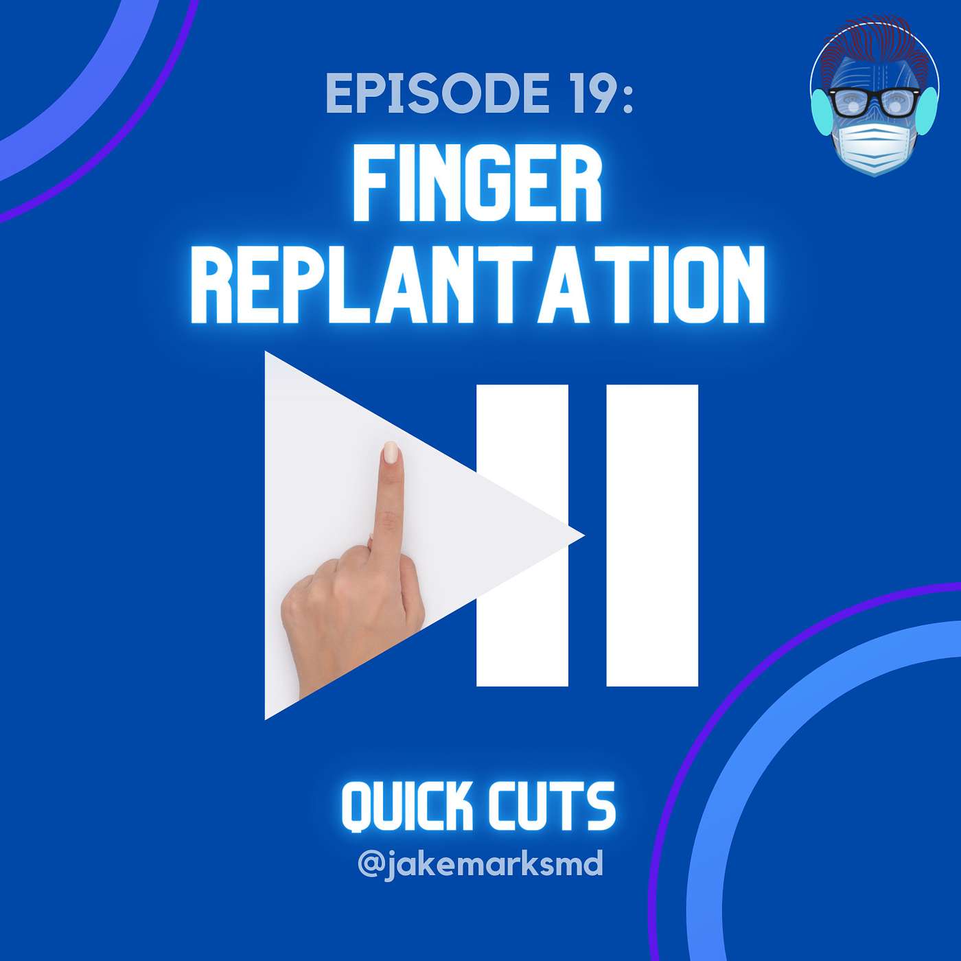Episode 19: Finger Replantation Episode 19: Finger Replantation
