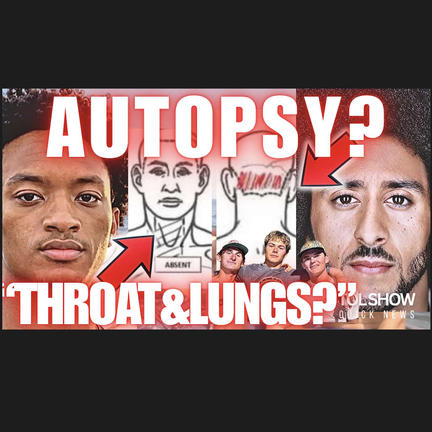 Nolan Wells: Colin Kaepernick BLASTS The DA Over Autopsy THROAT & LUNGS🫨‼️ episode artwork
