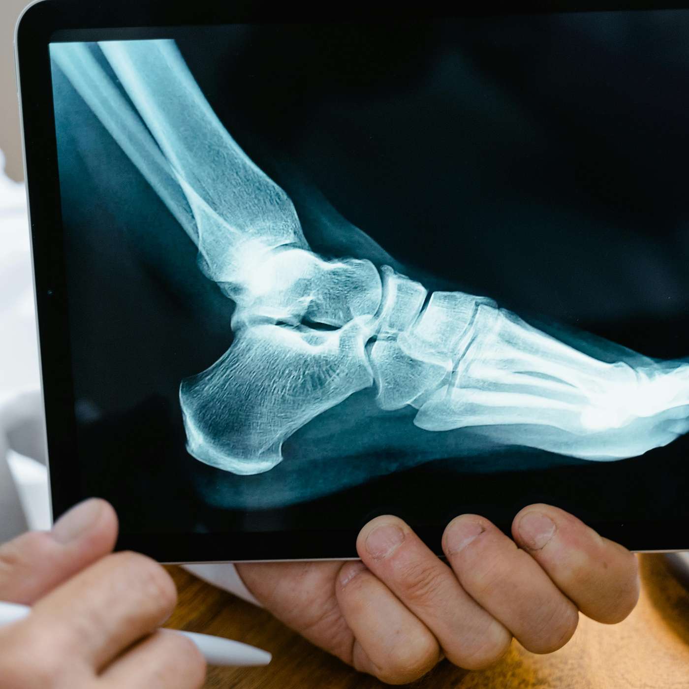 For Better Or Worse, Changes Happen For Better Or Worse, Changes Happen