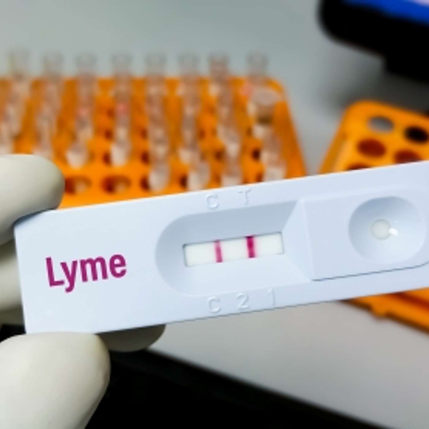Living with Lyme: Diagnosis, Treatment, and Healing Episode 1