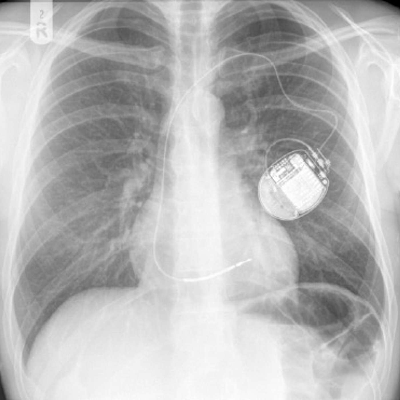 Medical Device Reps Podcast: Jimmy Winbourne/Pacemaker Rep