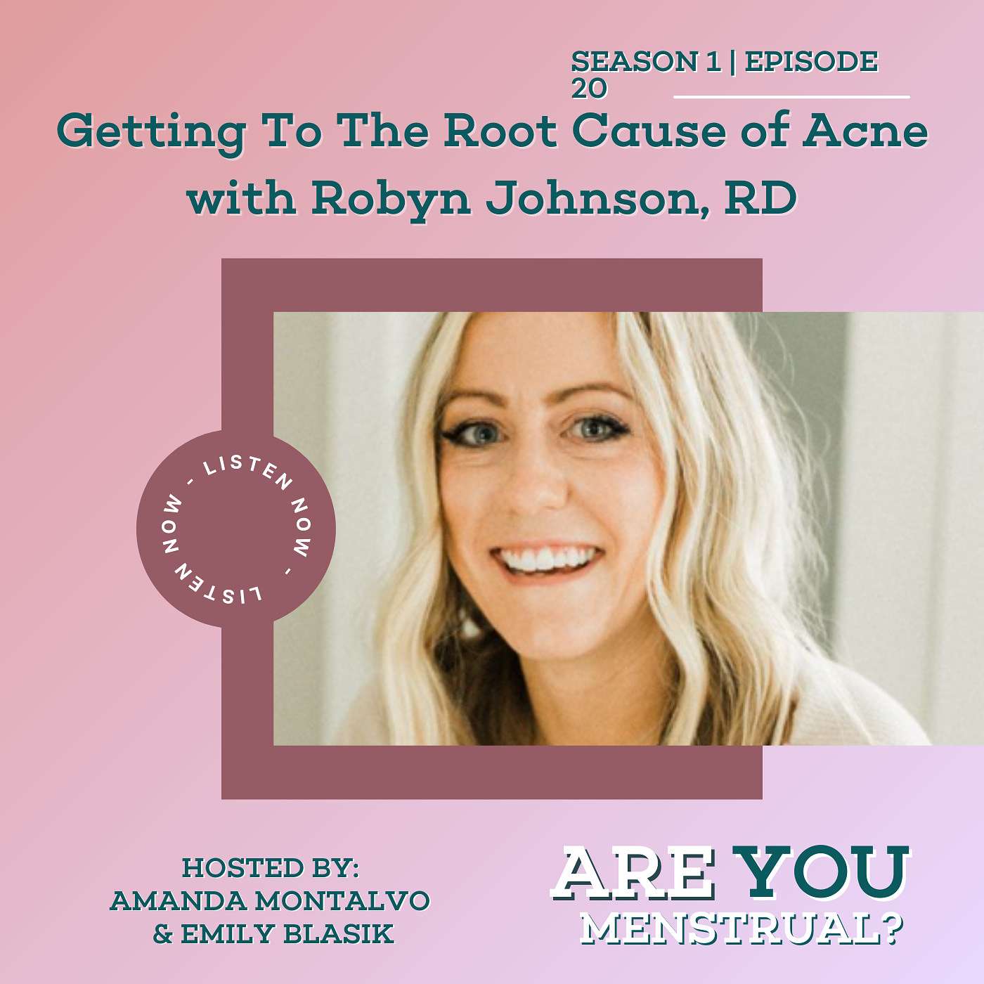 Getting To The Root Cause of Acne with Robyn Johnson, RD