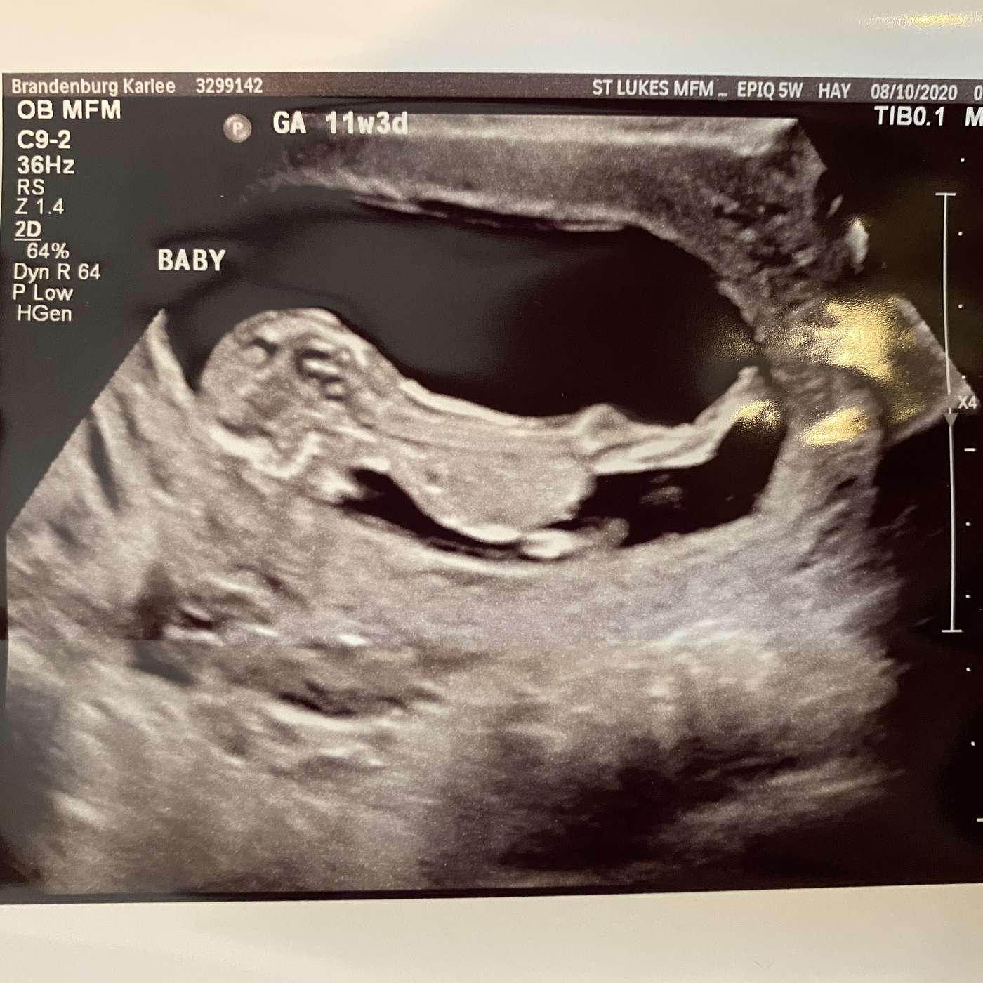 Preventative Screenings, Obstetrics