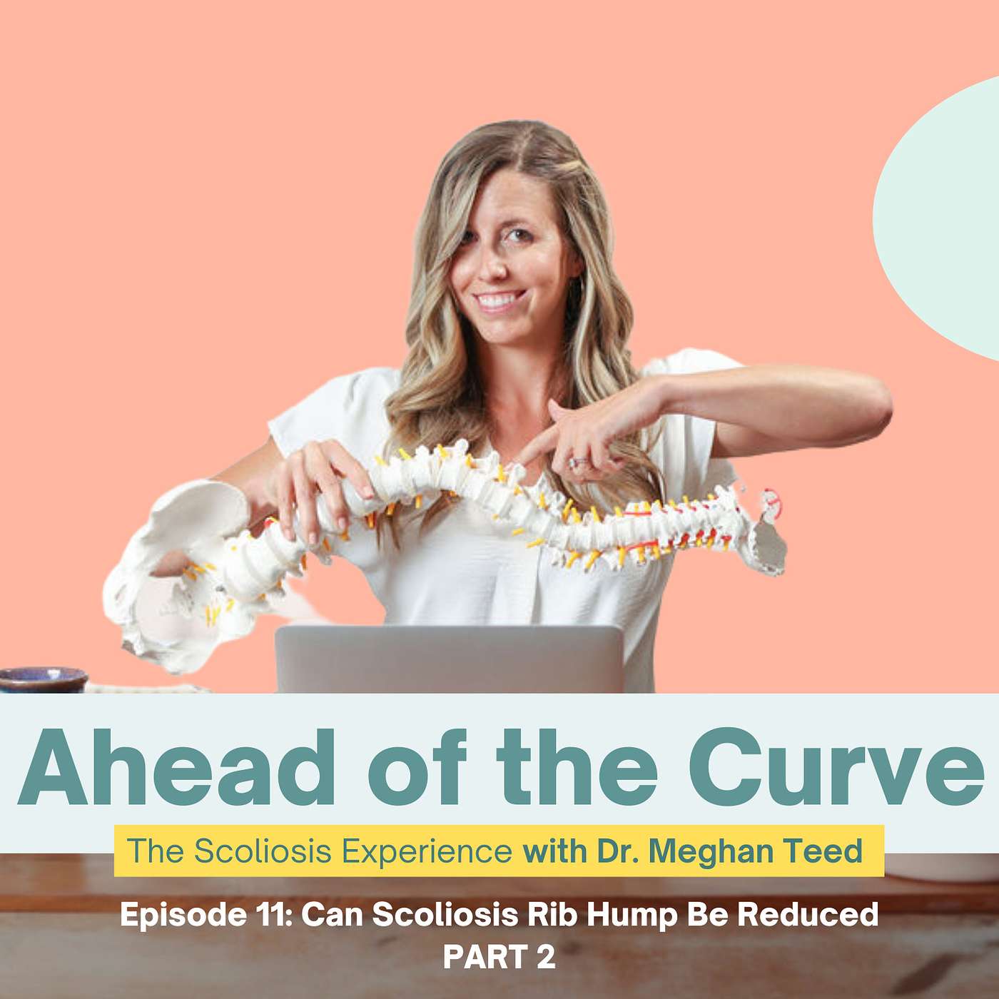 Episode 11: Can Scoliosis Rib Hump Be Reduced Part 2