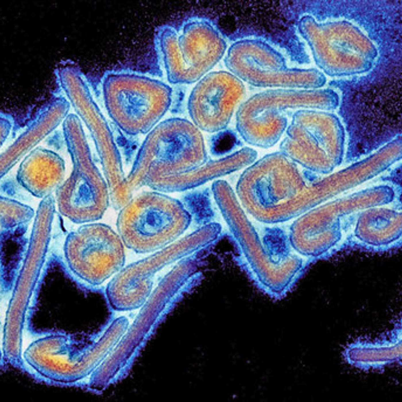 SSD 176 - Présent en Guinée équatoriale, le virus de Marburg menace le Cameroun episode artwork