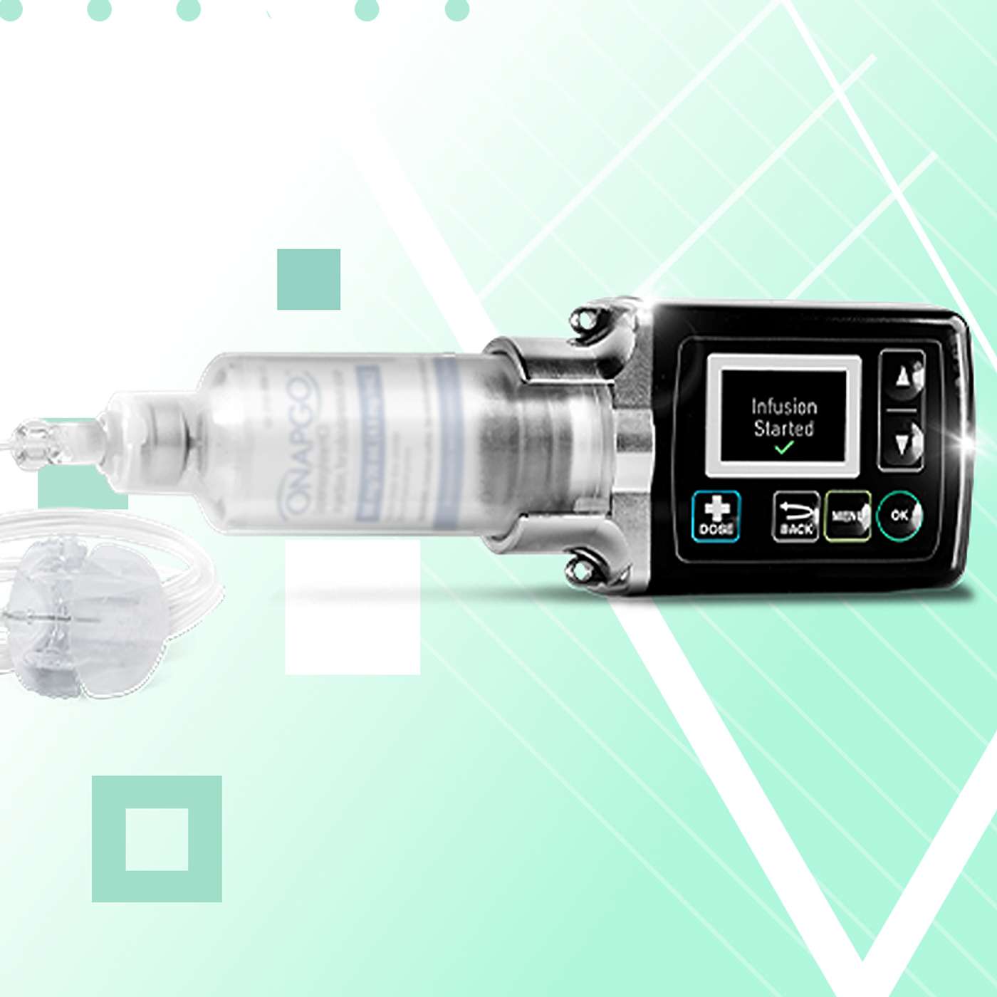 Subcutaneous Apomorphine Pump (Onapgo): An Exciting Non-Surgical Option for Parkinson's Disease