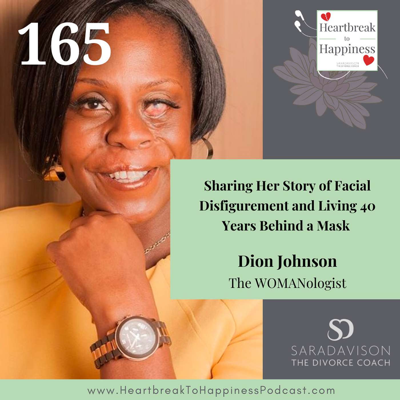 Sharing Her Story of Facial Disfigurement and Living 40 Years Behind a Mask : Dion Johnson True Story