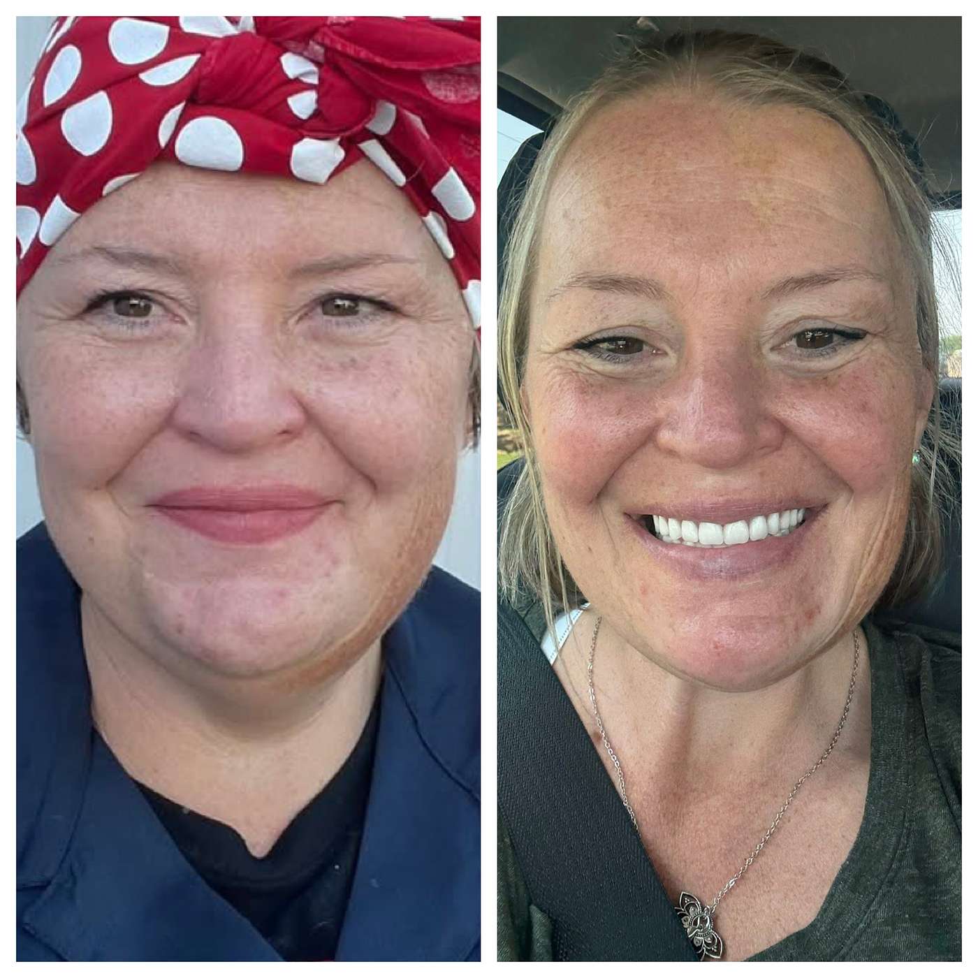 Boundless Body Radio