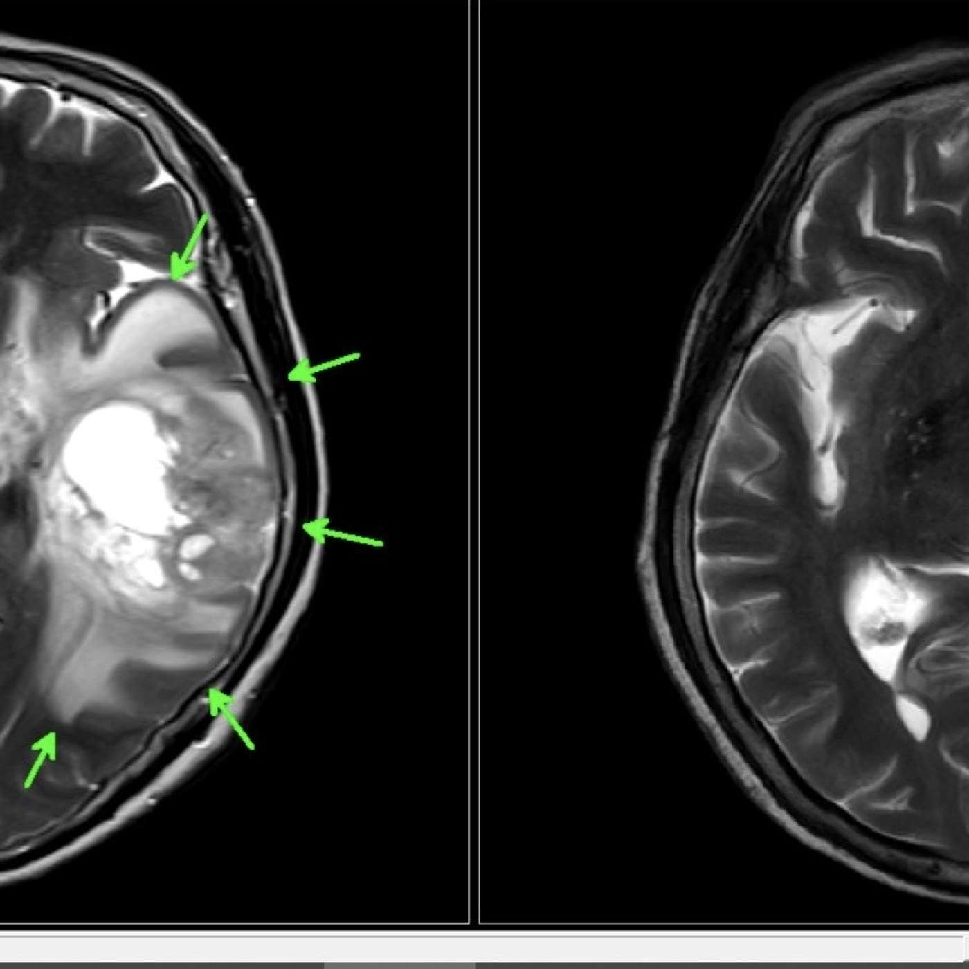 Ep 22 電腦斷層(CT)和磁振造影(MRI)有什麼不同呢!? Ep 22 電腦斷層(CT)和磁振造影(MRI)有什麼不同呢!?