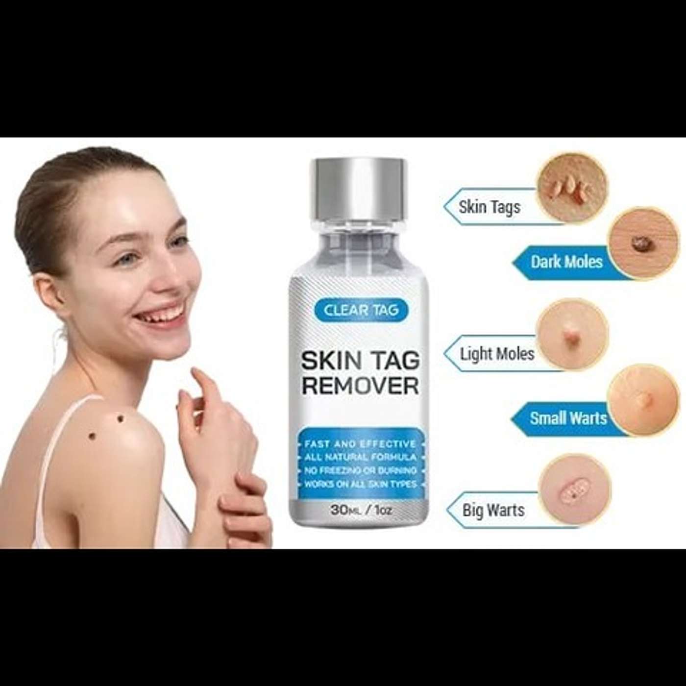 Clear Tag Skin Tag Remover Reviews podcast artwork