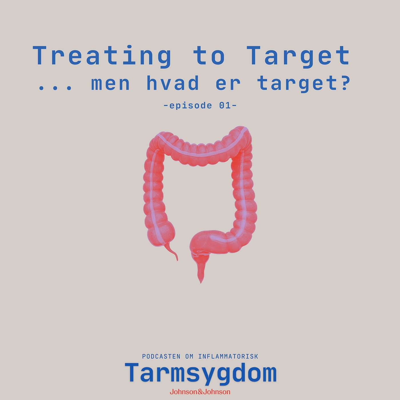 Treating to Target ...men hvad er target?