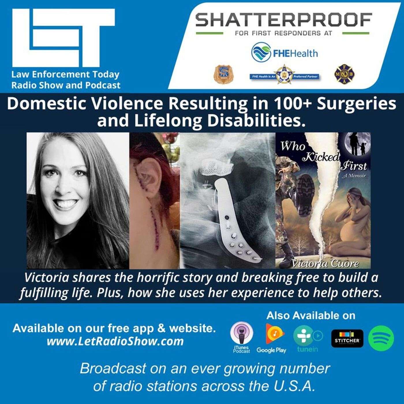 Domestic Violence Resulting in 100+ Surgeries and Lifelong Disabilities. Jay Wiley Interviews Victoria Cuore