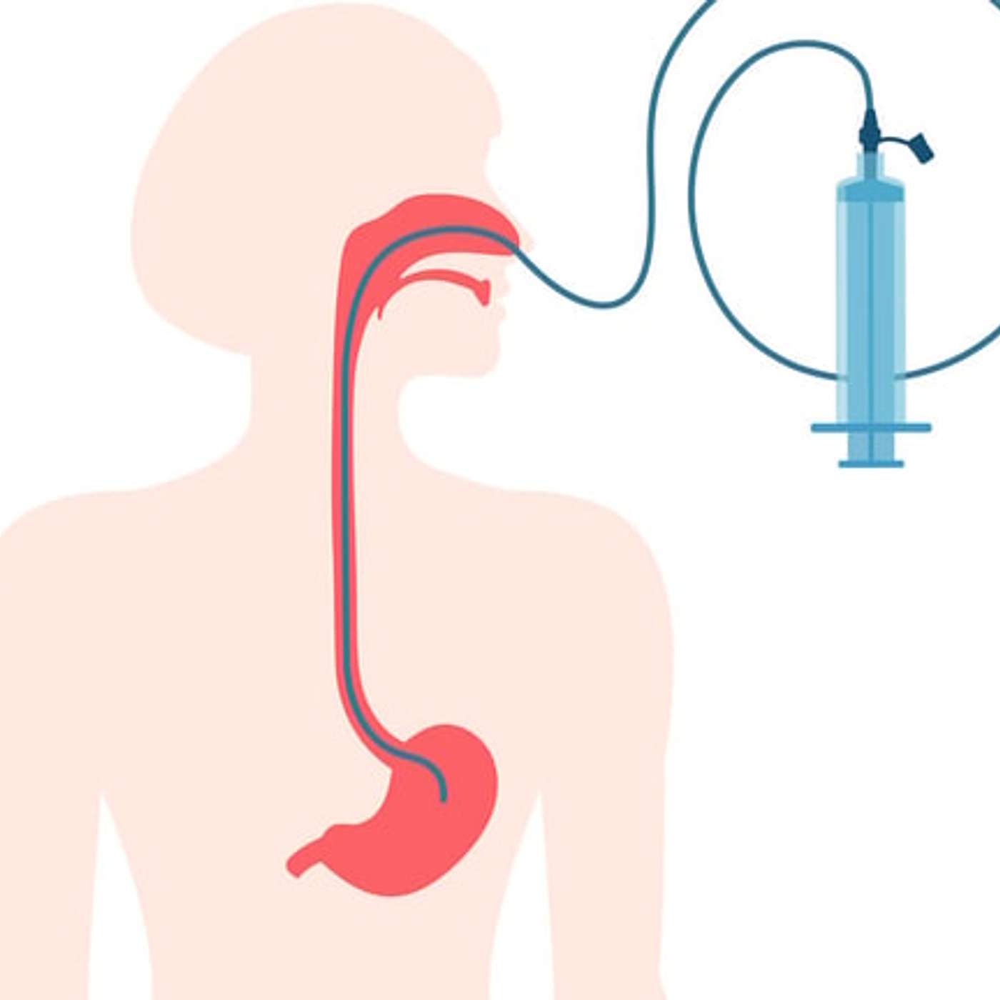 I would rather Eat Grass!