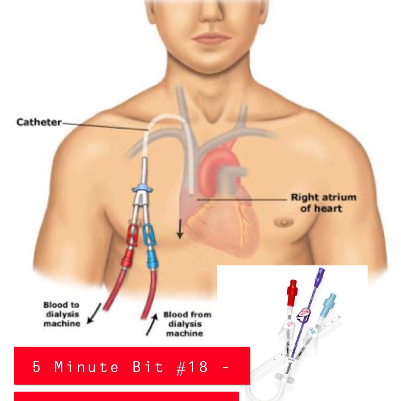 Resus Now