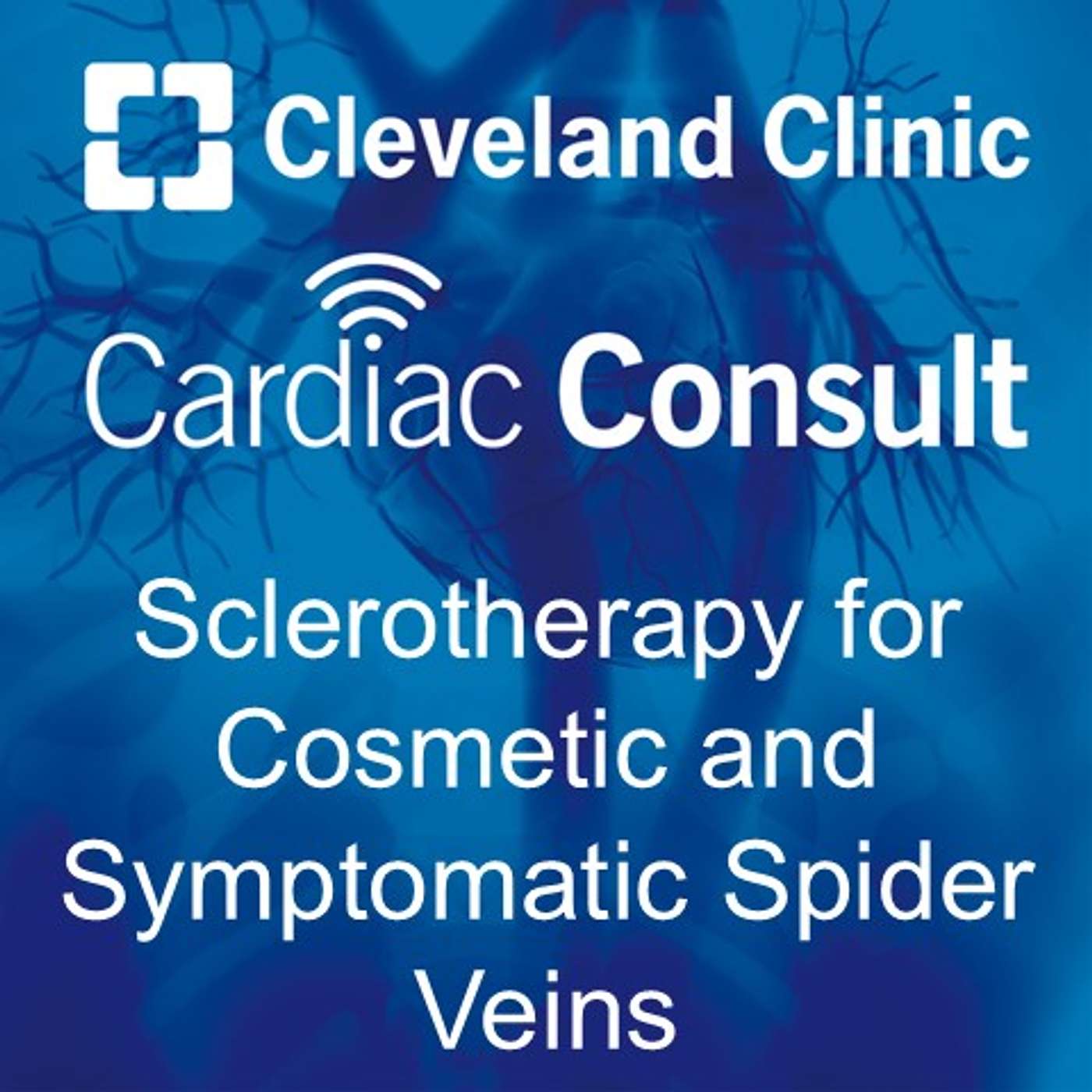 Sclerotherapy for Cosmetic and Symptomatic Spider Veins