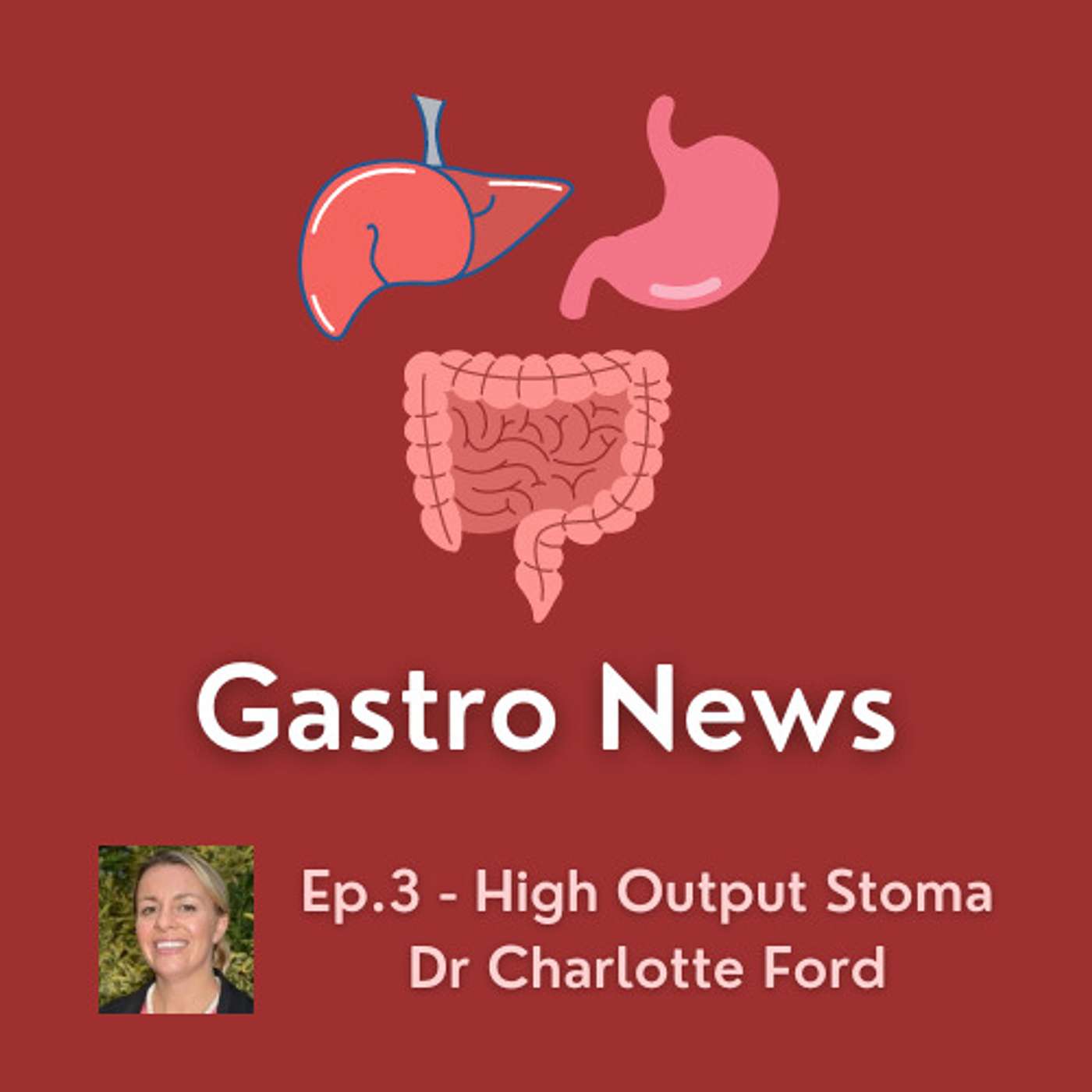 Episode 3 – High Output Stomas