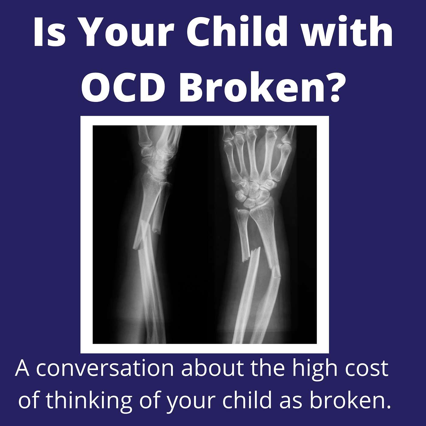 Is Your Child with OCD Broken?