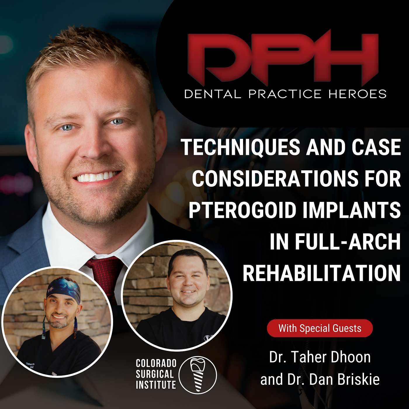 Clinical: Techniques and Case Considerations for Pterogoid Implants in Full-Arch Rehabilitation