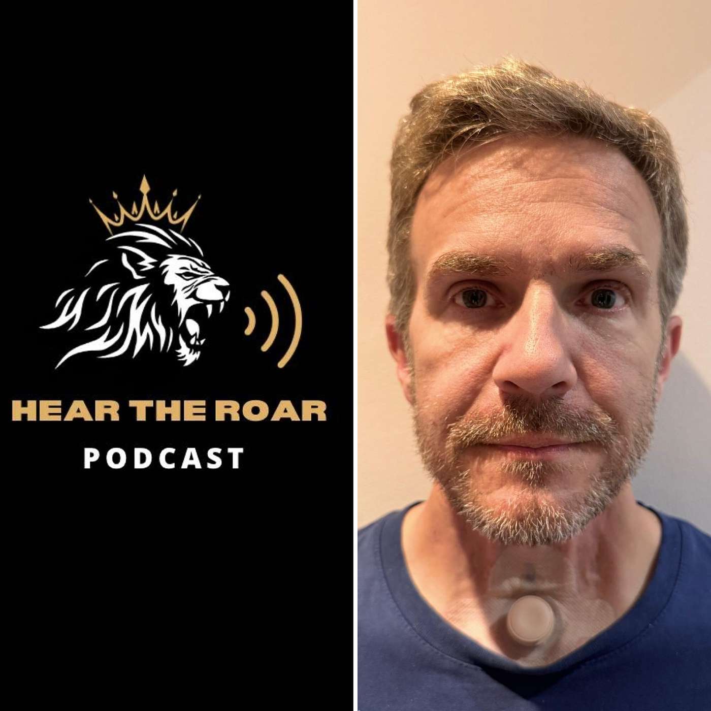Nigel Skilton - Vocal Chord Cancer Survivor - An inspirational warrior episode artwork