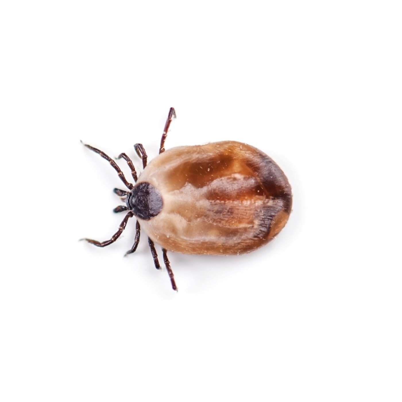 How to remove a deer tick from an 8-year-old girl’s eye.