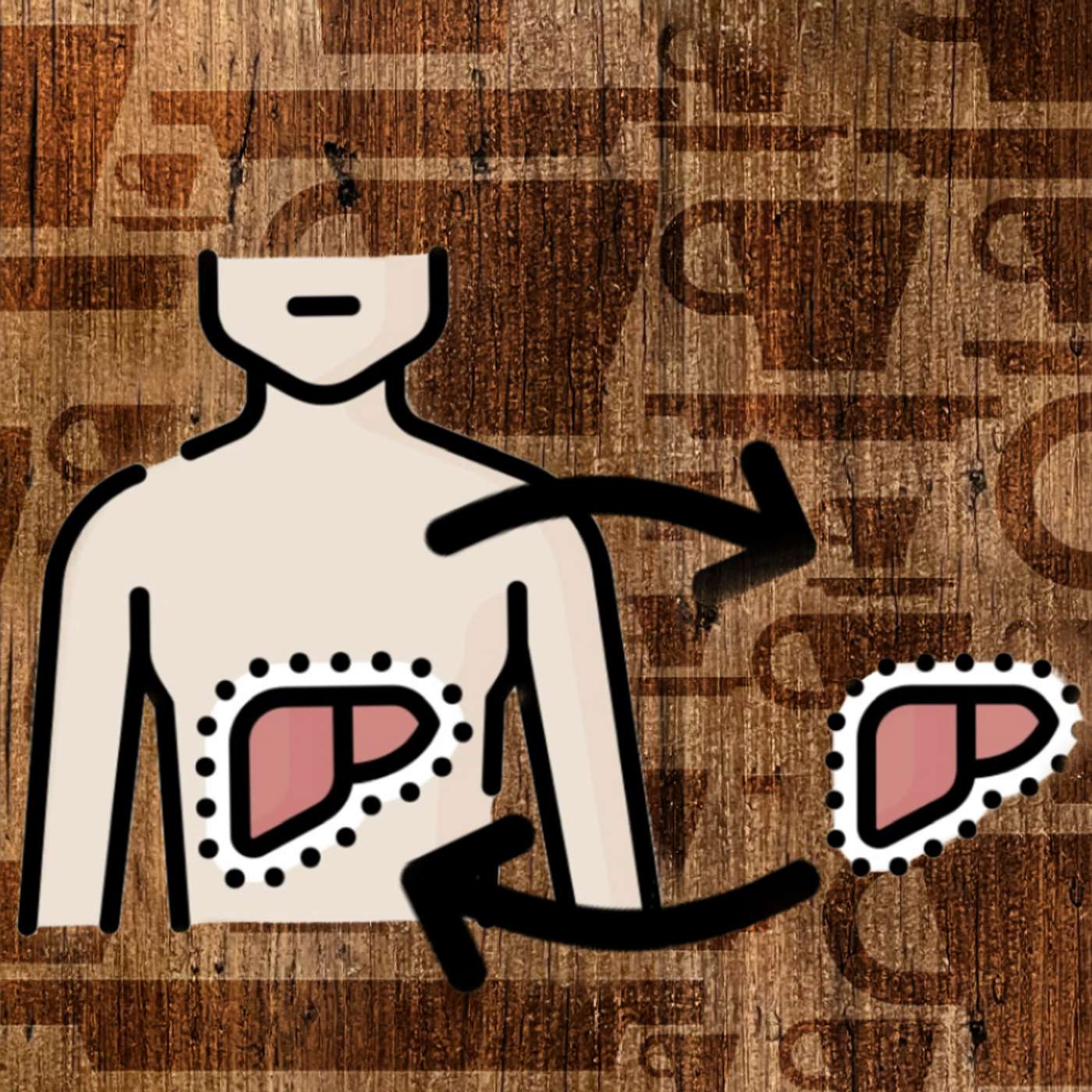 Akutes Leberversagen & Lebertransplantation ☕ (Microlearning • Espresso-Folge)