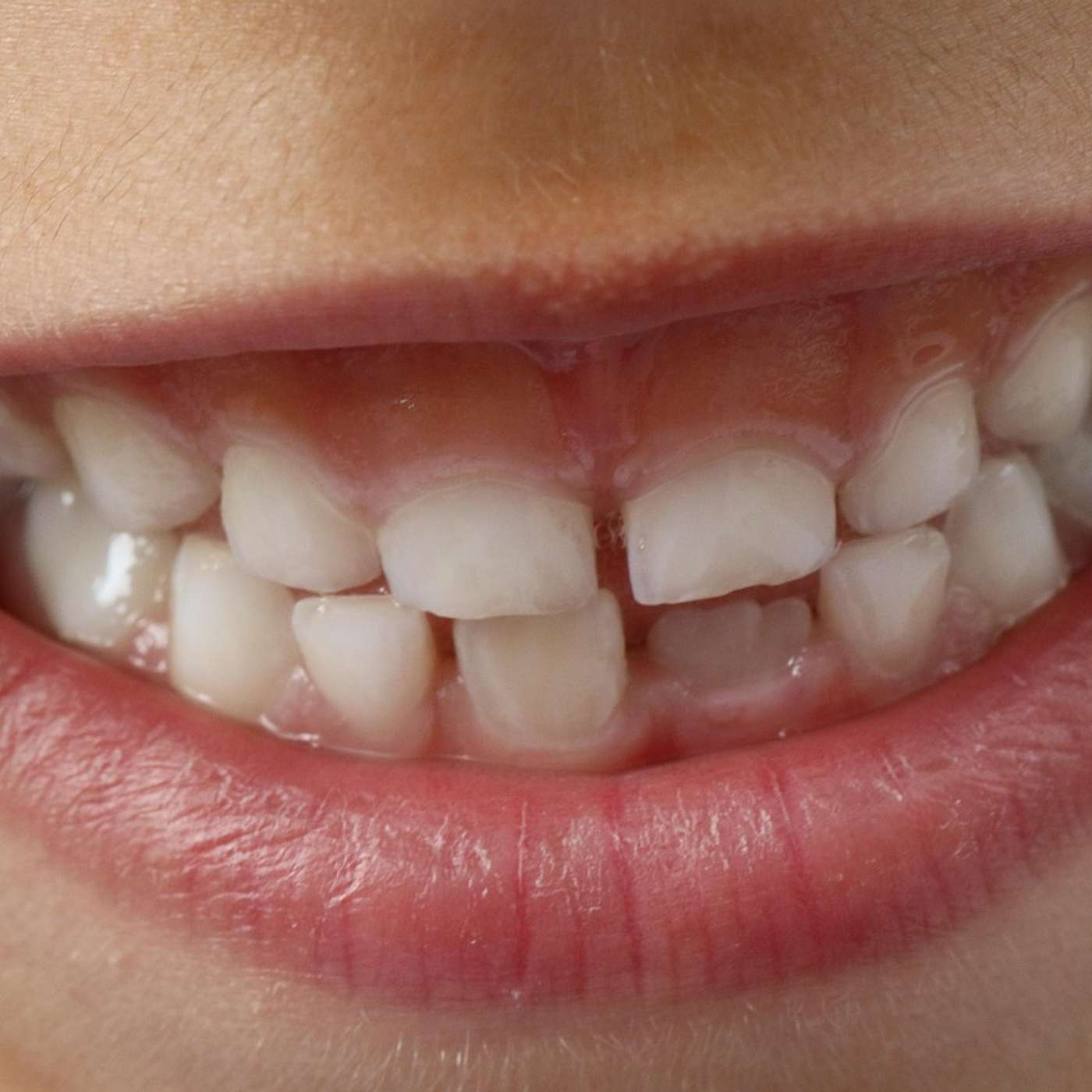 Growing New Teeth