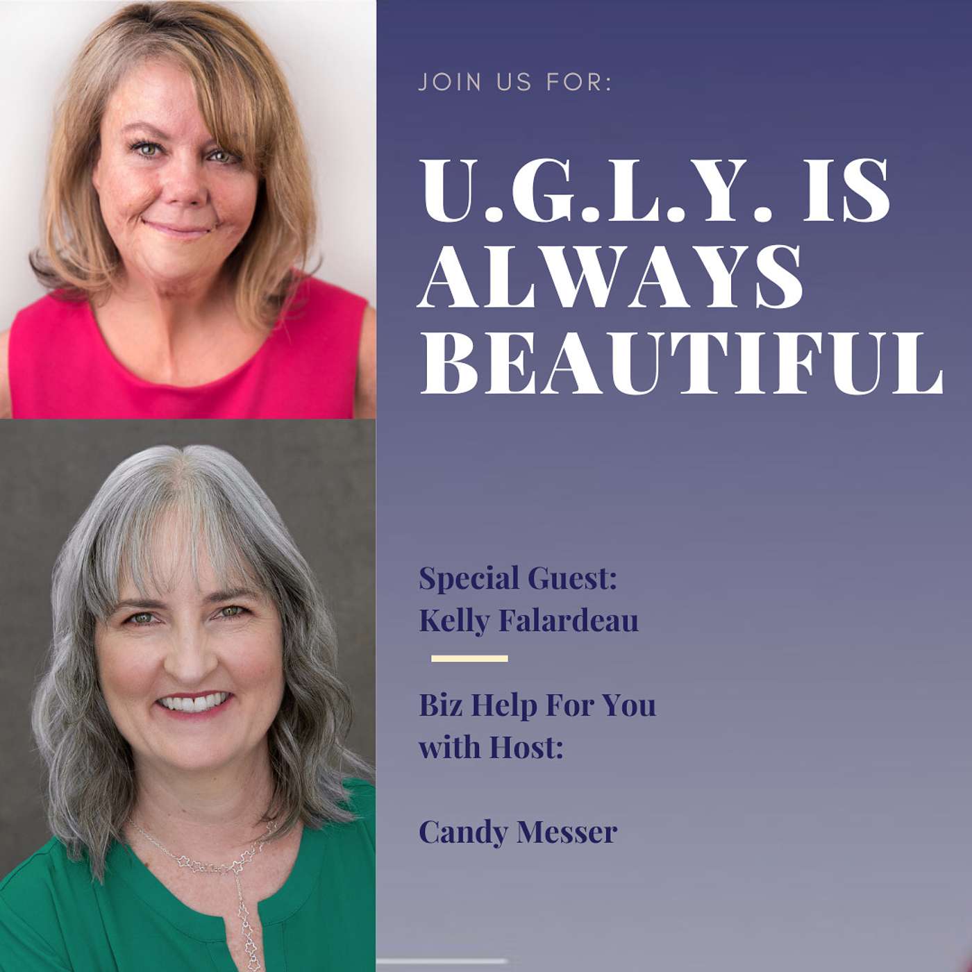 U.G.L.Y. is Always Beautiful with Kelly Falardeau