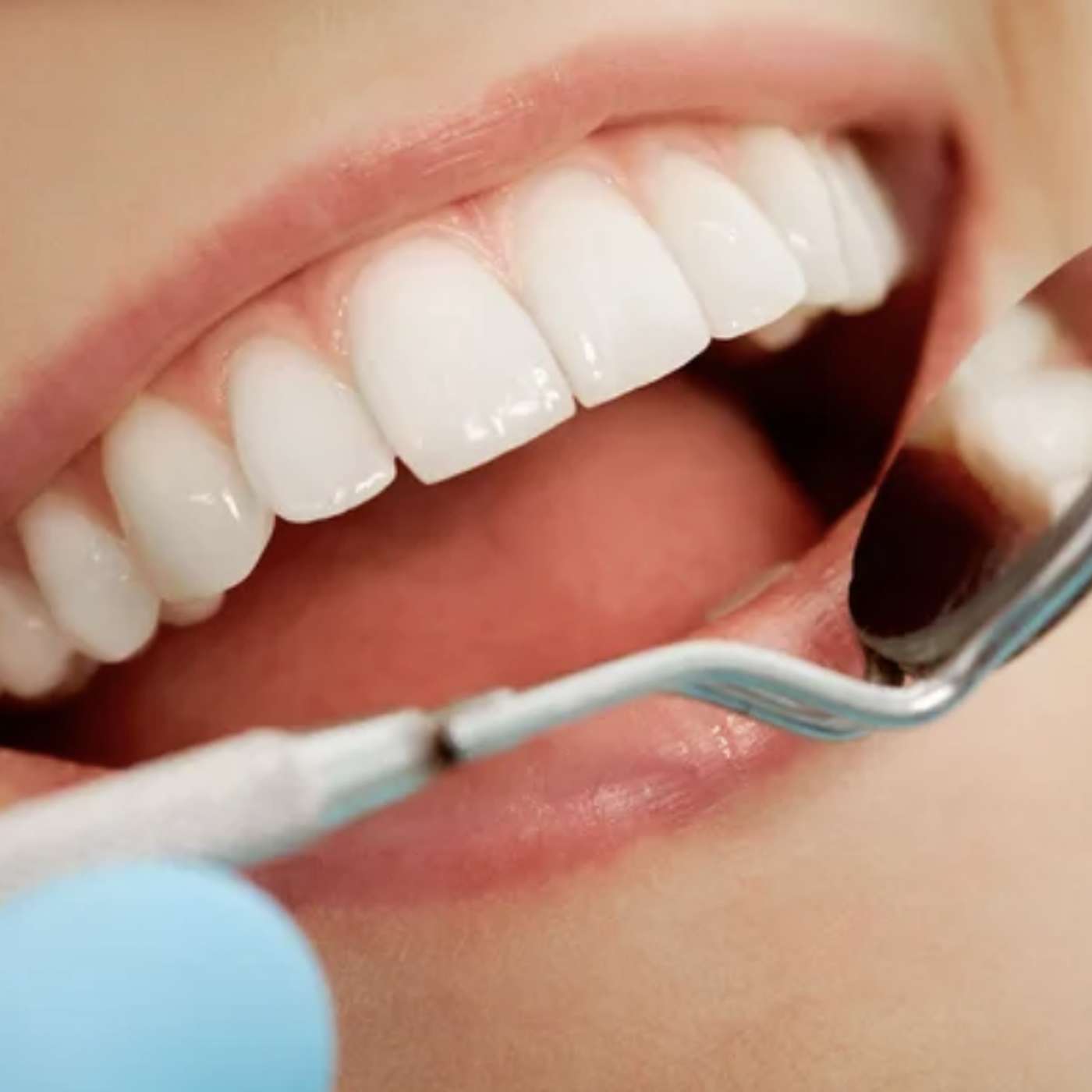 Stronger, Healthier Teeth with Biomimetic Dentistry: Mimicking Nature for Better Results episode artwork