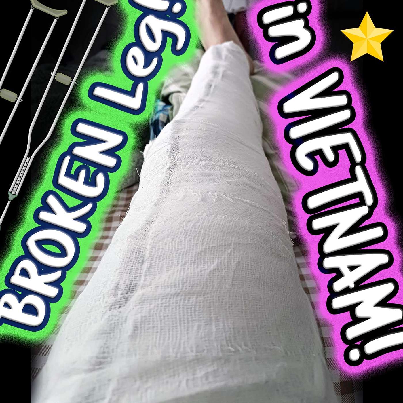 BROKEN LEG, in Vietnam! (Story w/ Past Continuous + 3rd Conditional)