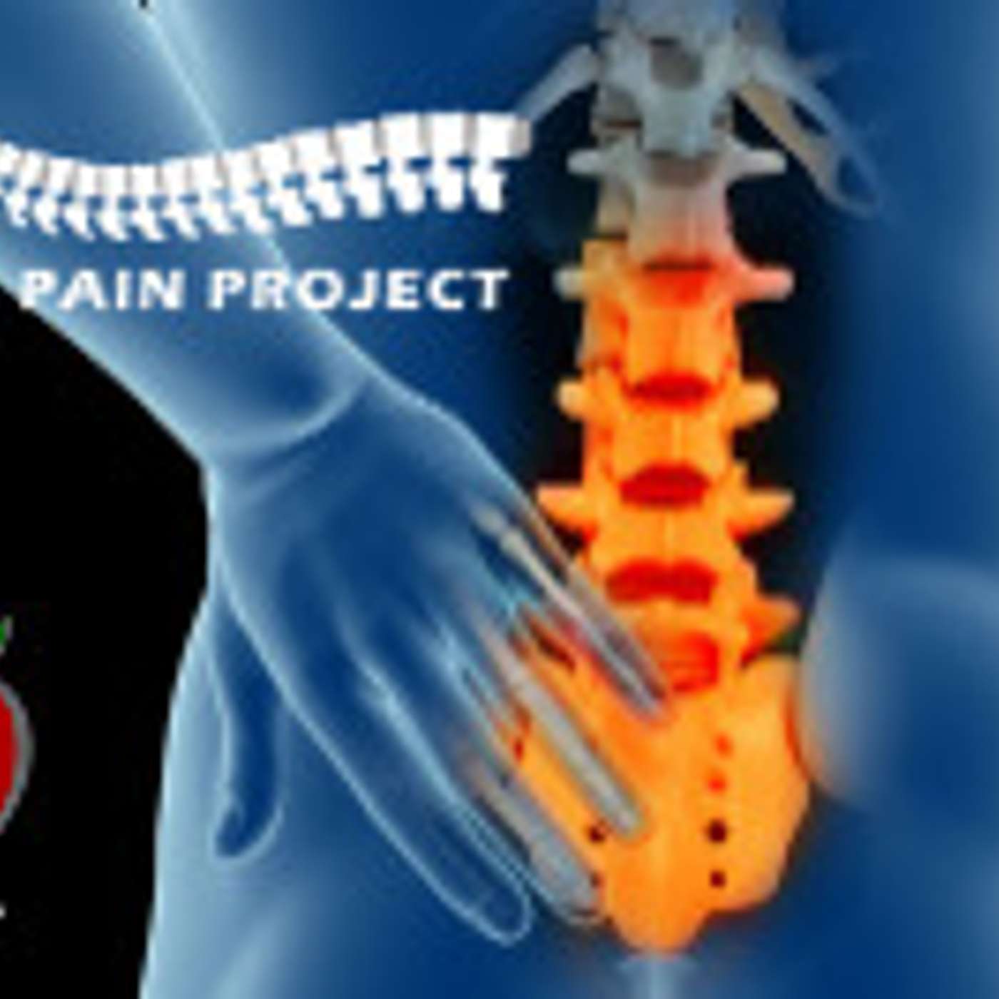 What is The Back Pain Project? Are you listening Stamford, Norwalk, and Darien CT? episode artwork