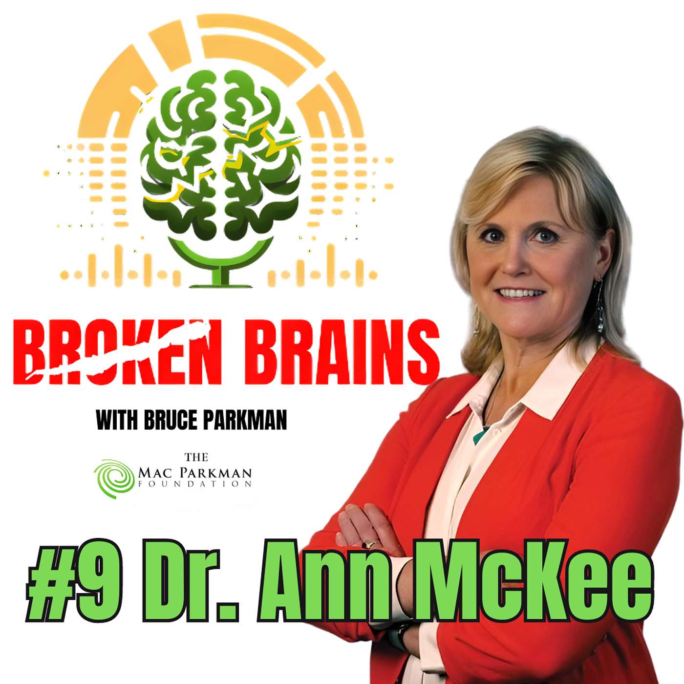 Broken Brains with Bruce Parkman