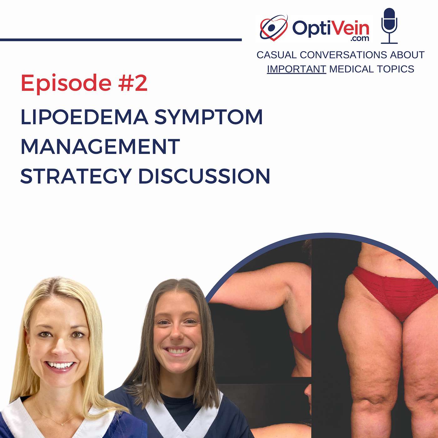 Lipoedema symptom management strategy discussion