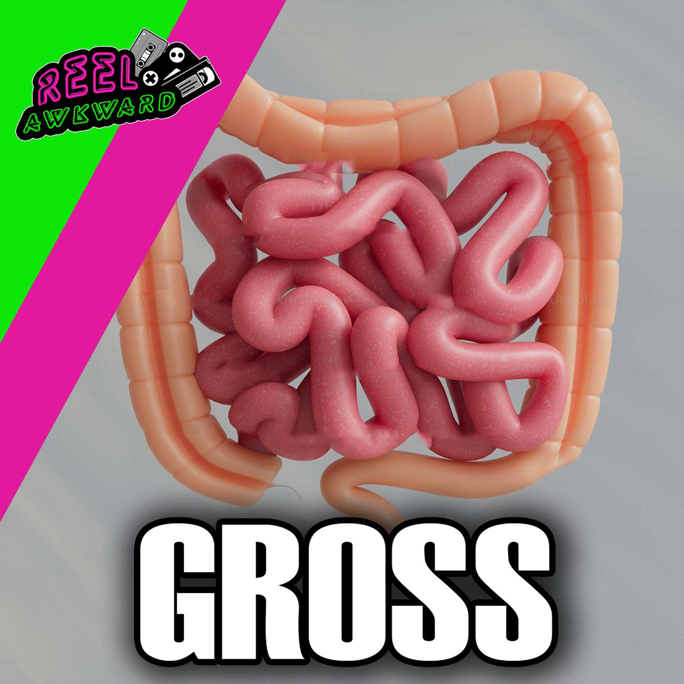 Are we Gross!?