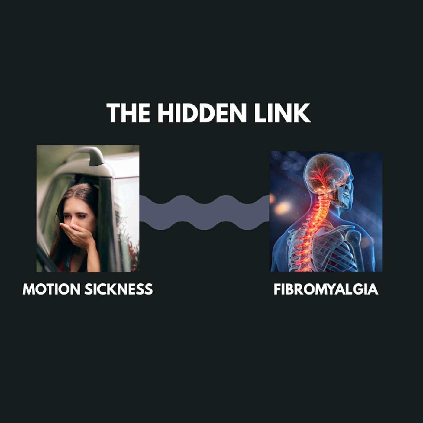 Ep 239 What Motion Sickness Teaches us about Fibromyalgia Ep 239 What Motion Sickness Teaches us about Fibromyalgia