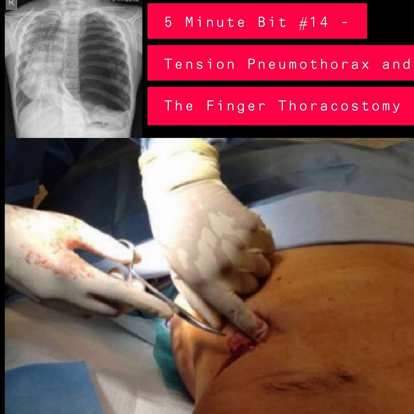 Resus Now