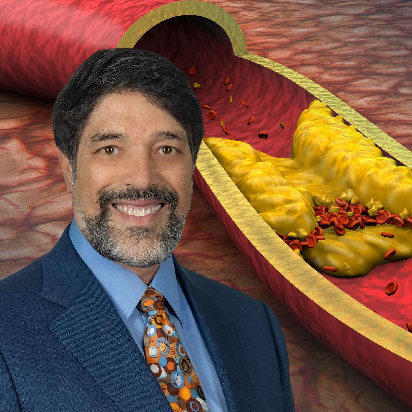 Early Risk Detection and Early Treatment: 2026  Lp(a) & Cholesterol Guidelines episode artwork