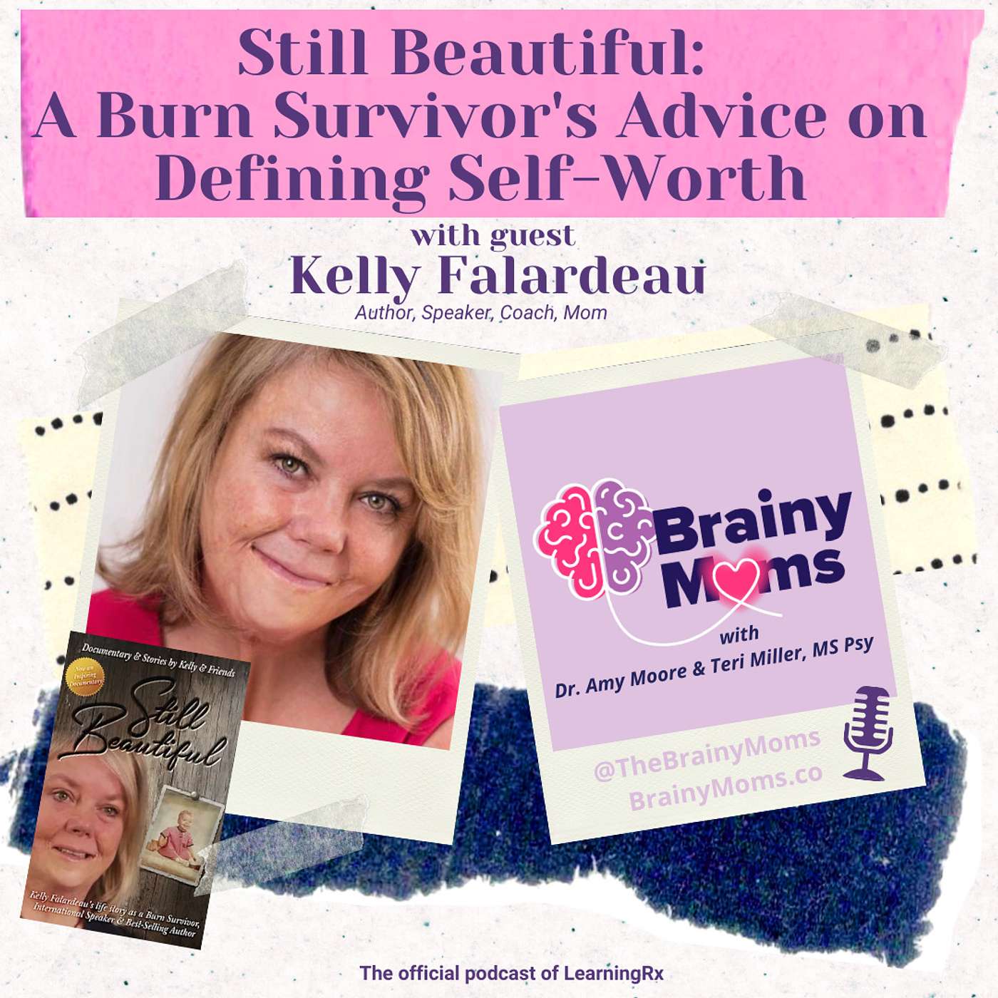 Still Beautiful: A Burn Survivor's Advice on Defining Self-Worth with guest Kelly Falardeau