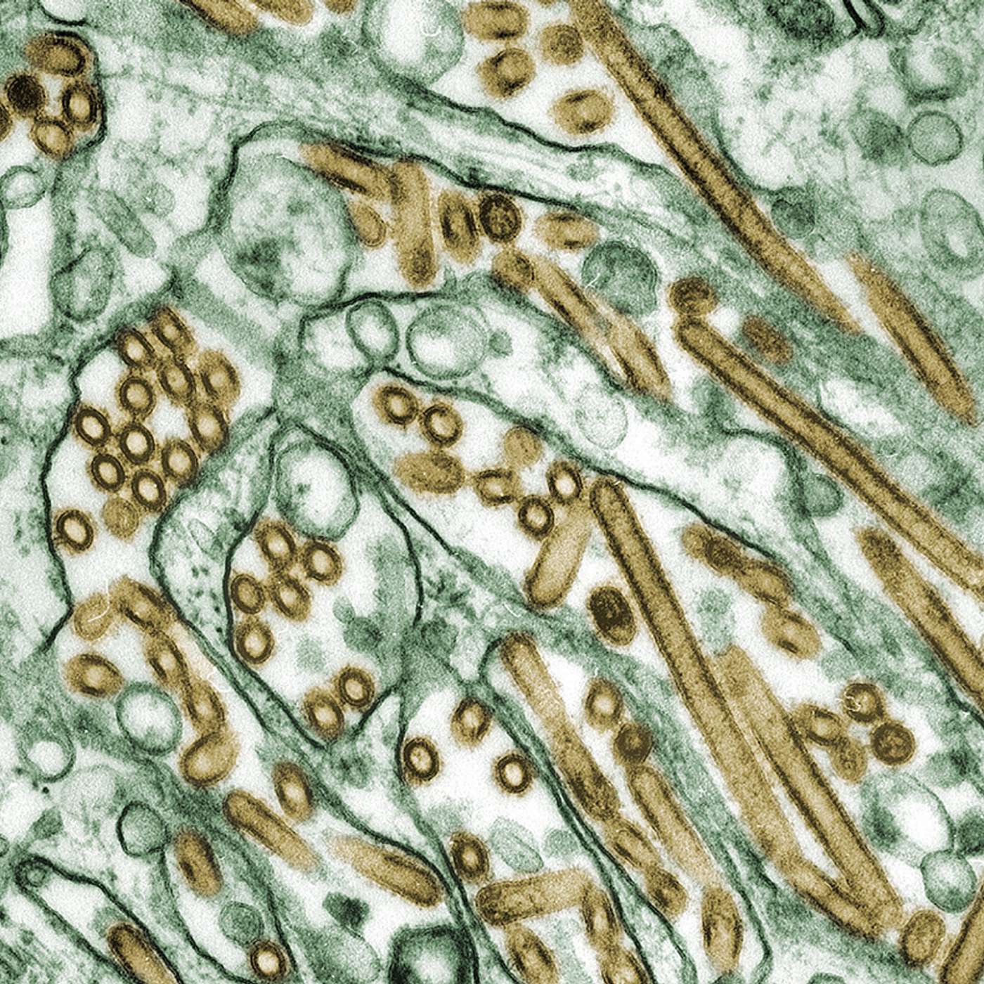Why Fears Of A New Viral Pandemic Are On The Rise